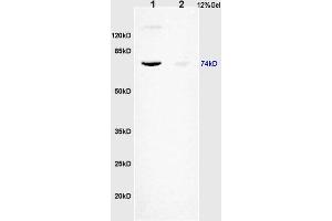 L1 human colon carcinoma lysates L2 rat brain lysates probed with Anti KIFC1 Polyclonal Antibody, Unconjugated (ABIN873143) at 1:200 overnight at 4 °C.