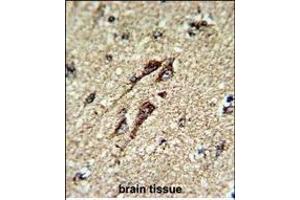 Formalin-fixed and paraffin-embedded human brain tissue reacted with ATP5B Antibody (Center), which was peroxidase-conjugated to the secondary antibody, followed by DAB staining.