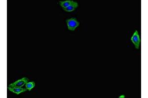 Immunofluorescent analysis of HepG2 cells using ABIN7153773 at dilution of 1:100 and Alexa Fluor 488-congugated AffiniPure Goat Anti-Rabbit IgG(H+L) (GMIP anticorps  (AA 719-858))