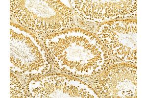 ABIN6263265 and ABIN6268849 at 1/100 staining Rat testis tissue by IHC-P. (MKL1 anticorps  (N-Term))