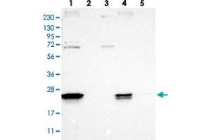 Western blot analysis of Lane 1: RT-4, Lane 2: Human Plasma, Lane 3: U-251 MG, Lane 4: Liver, Lane 5: Tonsil with FAM213A polyclonal antibody .
