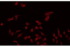 ABIN6272303 staining MDA-MB-435 by IF/ICC. (PMP22 anticorps  (C-Term))