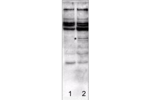 Affinity Purified antibody to Caspase-2  was used at a 1:750 dilution to detect rat caspase-2 in transfected human 292 cell lysates by Western blot.