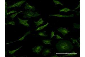Immunofluorescence of monoclonal antibody to MAPK8 on HeLa cell.