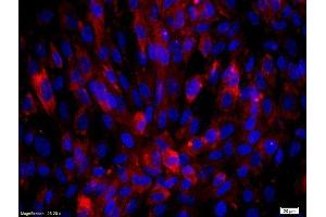 Human endothelial cells labeled with Rabbit Anti-Biglycan Polyclonal Antibody, Unconjugated  was used to stain the cell nuclei (Biglycan anticorps  (AA 101-200))