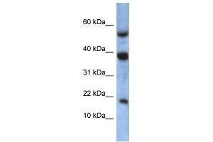 ATXN7L1 antibody used at 1 ug/ml to detect target protein. (ATXN7L1 anticorps  (Middle Region))