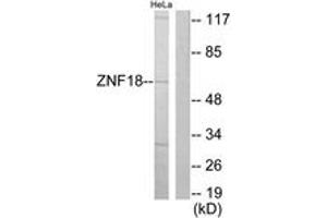 Western blot analysis of extracts from HeLa cells, using ZNF18 Antibody. (ZNF18 anticorps  (AA 261-310))