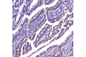 IHC analysis of Cannabinoid Receptor I using anti-Cannabinoid Receptor I antibody .