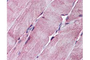 Anti-SGCE antibody IHC of human skeletal muscle. (SGCE anticorps  (AA 36-85))