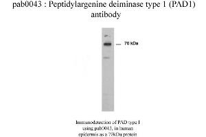 Image no. 2 for anti-Peptidyl Arginine Deiminase, Type I (PADI1) antibody (ABIN346990) (PADI1 anticorps)