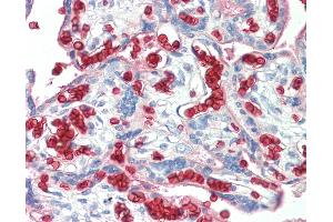 Anti-Erythrocytes antibody IHC staining of human placenta. (Erythrocytes anticorps)