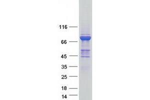 Validation with Western Blot