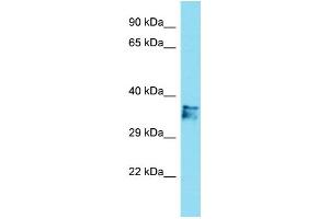 Host: Rabbit Target Name: C14orf79 Sample Type: Jurkat Whole Cell lysates Antibody Dilution: 1. (C14ORF79 anticorps  (N-Term))