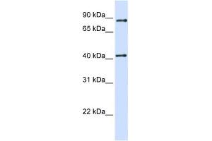 WB Suggested Anti-TXNDC13 Antibody Titration:  0. (TMX4 anticorps  (C-Term))