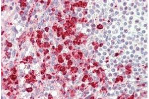 Human Spleen: Formalin-Fixed, Paraffin-Embedded (FFPE)