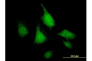 Immunofluorescence of purified MaxPab antibody to SNF1LK on HeLa cell.