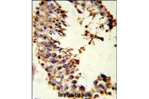 Formalin-fixed and paraffin-embedded human testis tissue reacted with ACR Antibody , which was peroxidase-conjugated to the secondary antibody, followed by DAB staining.