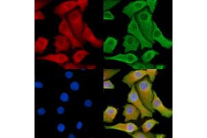 ABIN7095288 and ABIN7099345 staining Hela cells by IF/ICC. (SOCS5 anticorps)