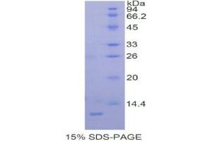 SDS-PAGE (SDS) image for Preferentially Expressed Antigen in Melanoma (PRAME) (AA 416-502) protein (His tag) (ABIN1877432) (PRAME Protein (AA 416-502) (His tag))
