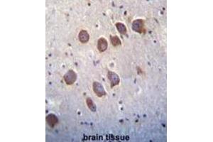 Immunohistochemistry (IHC) image for anti-Diacylglycerol Kinase, theta 110kDa (DGKQ) antibody (ABIN3003694)