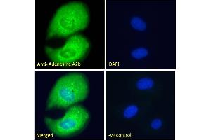 ABIN185477 Immunofluorescence analysis of paraformaldehyde fixed U2OS cells, permeabilized with 0.