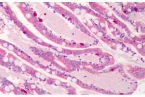 Human Small Intestine: Formalin-Fixed, Paraffin-Embedded (FFPE) (C1QTNF4 anticorps  (C-Term))