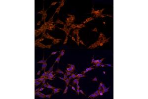 Immunofluorescence analysis of PC-12 cells using NOD2 Rabbit pAb (ABIN7269065) at dilution of 1:150 (40x lens).