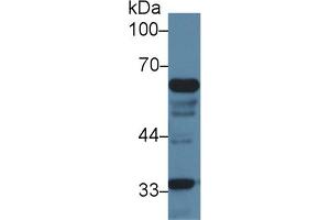 Detection of IkBz in Mouse Liver lysate using Polyclonal Antibody to Inhibitory Subunit Of NF Kappa B Zeta (IkBz)
