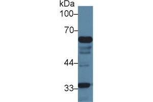Detection of IkBz in Mouse Liver lysate using Polyclonal Antibody to Inhibitory Subunit Of NF Kappa B Zeta (IkBz) (Inhibitory Subunit of NF-KappaB zeta (AA 414-654) anticorps)
