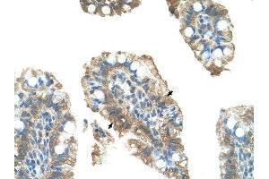 PARP6 antibody was used for immunohistochemistry at a concentration of 4-8 ug/ml to stain Epithelial cells of intestinal villus (arrows) in Human Intestine. (PARP6 anticorps)