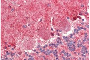 Brain, cerebellum, Human: Formalin-Fixed, Paraffin-Embedded (FFPE)