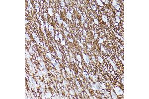 Immunohistochemistry of paraffin-embedded Rat brain using CNTN1 antibody (ABIN7266492) at dilution of 1:100 (40x lens).