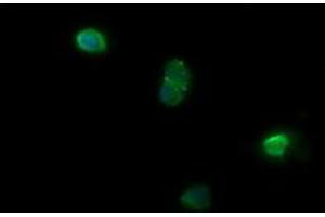 Image no. 3 for anti-NADPH Dependent Diflavin Oxidoreductase 1 (NDOR1) antibody (ABIN1499655)