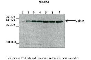 Lanes:  Lane1: 30 ug Human liver Lane2: 30 ug Rat liver Lane3: 30 ug Mouse (wild-type) liver Lane4: 30 ug Mouse [AMPK alpha 1/2(-/-)] liver Lane5: 30 ug Human muscle Lane6: 30 ug Rat muscle Lane7: 30 ug Mouse muscle Primary Antibody Dilution:  1:1000 Secondary Antibody:   Secondary Antibody Dilution:  1:10000 Gene Name:  NDUFS1 Submitted by:  Dr.