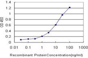 Detection limit for recombinant GST tagged MAP3K7IP1 is approximately 0.