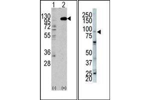 (LEFT) Western blot analysis of anti-hFGFR2-C808 Pab in 293 cell line lysates transiently transfected with the FGFR2 gene (2ug/lane). (FGFR2 anticorps  (C-Term))