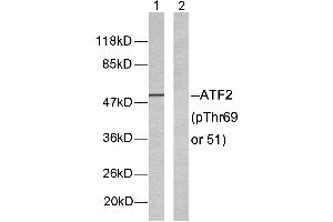 Western blot analysis of extracts from LOVO cells. (ATF2 anticorps  (pThr51, pThr69))