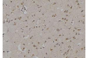 ABIN6269295 at 1/100 staining Human brain tissue by IHC-P. (14-3-3 zeta anticorps  (Internal Region))