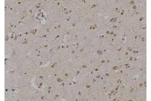 ABIN6269295 at 1/100 staining Human brain tissue by IHC-P.
