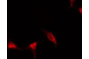 ABIN6267464 staining HeLa by IF/ICC.