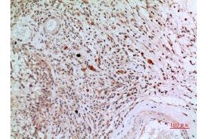 Immunohistochemistry (IHC) analysis of paraffin-embedded Human Brain, antibody was diluted at 1:100. (CD3D anticorps  (Internal Region))