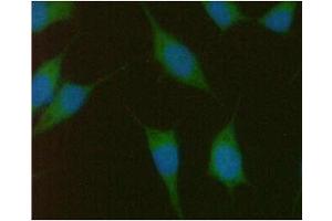 ICC/IF analysis of PMVK in PC3 cells line, stained with DAPI (Blue) for nucleus staining and monoclonal anti-human PMVK antibody (1:100) with goat anti-mouse IgG-Alexa fluor 488 conjugate (Green).
