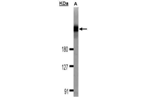 DOCK1 抗体  (C-Term)