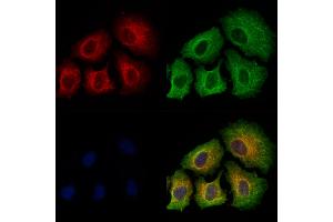 ABIN6256390 and ABIN6267486 staining Hela cells(4h of LPS treatment) by IF/ICC. (IRS1 anticorps  (pSer639))