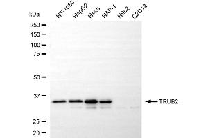 Western blotting analysis using TRUB2 antibody (ABIN7800652).
