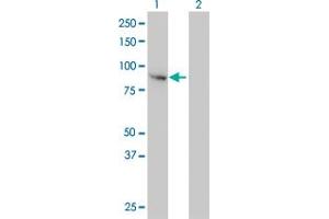 Western Blot analysis of FES expression in transfected 293T cell line by FES monoclonal antibody (M01), clone 3A3-1E5.