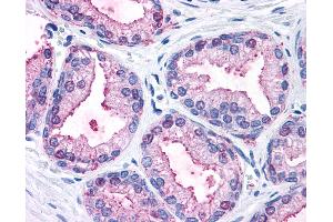 Anti-MAPK3 / ERK1 antibody IHC of human prostate. (ERK1 anticorps  (Internal Region))