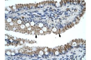 ZNF683 antibody was used for immunohistochemistry at a concentration of 4-8 ug/ml to stain Epithelial cells of intestinal villus {arrows) in Human Intestine. (ZNF683 anticorps  (N-Term))