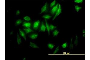 Immunofluorescence of monoclonal antibody to NME2 on HeLa cell. (NME2 anticorps  (AA 51-152))