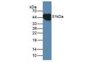 Figure. (KRT14 anticorps  (AA 111-418))
